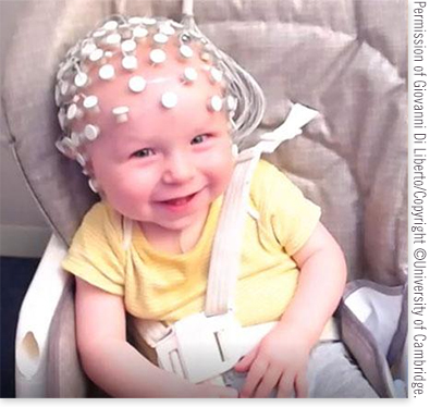 Photo of baby wearing a helmet made of audio sensors